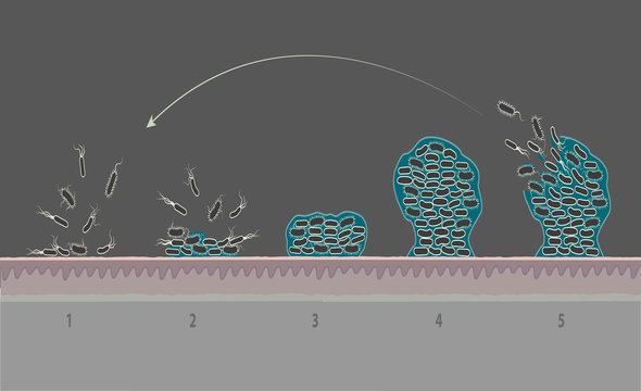 Biofilm