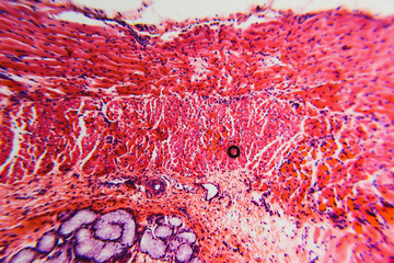 Cross section esophagus dog