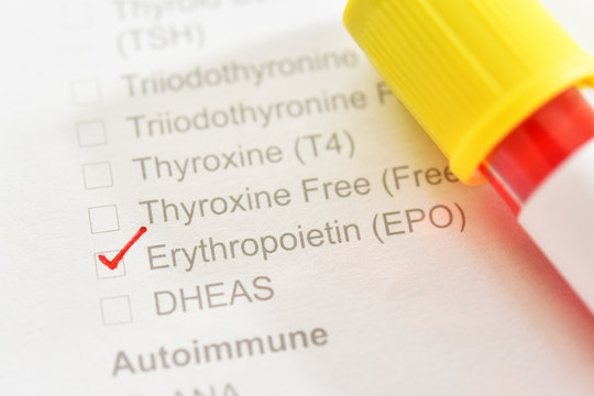 Blood Sample Tube For Erythropoietin Test