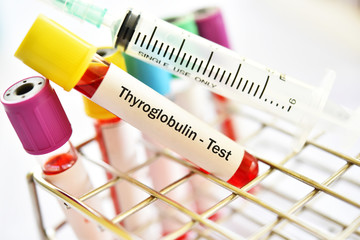 Blood sample tube for thyroglobulin test