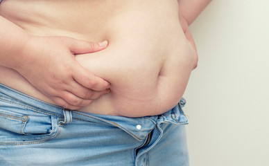 Obesity. Obese Woman Holding His Belly Fat With Both Hands Giving An Expression Of Shock.