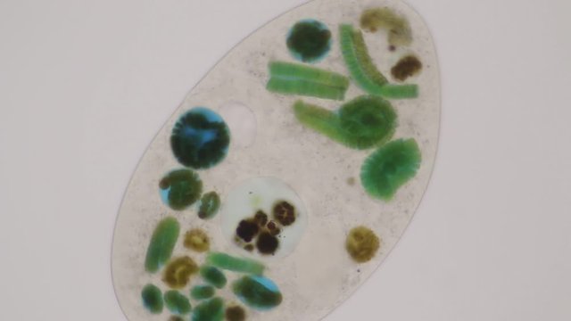 Frontonia sp. is a genus of free-living unicellular ciliate protists under the microscope.