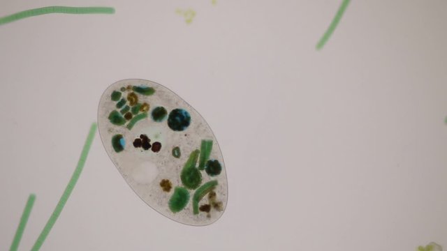 Frontonia sp. is a genus of free-living unicellular ciliate protists under the microscope.