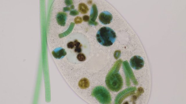 Frontonia sp. is a genus of free-living unicellular ciliate protists under the microscope.