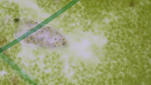 Frontonia sp. is a genus of free-living unicellular ciliate protists under the microscope.