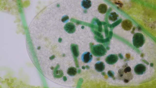 Frontonia sp. is a genus of free-living unicellular ciliate protists under the microscope.