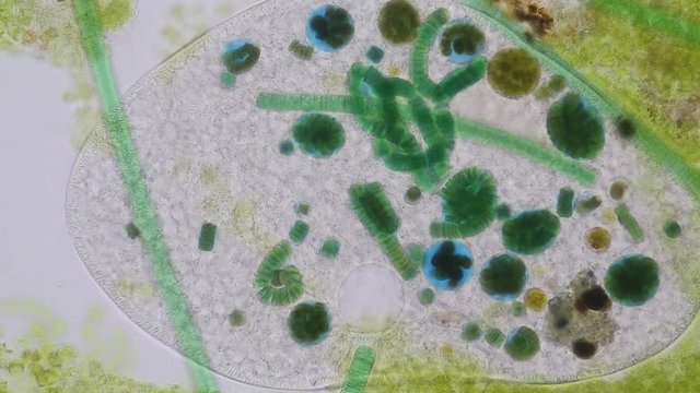 Frontonia sp. is a genus of free-living unicellular ciliate protists under the microscope.