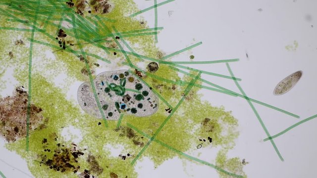 Frontonia sp. is a genus of free-living unicellular ciliate protists under the microscope.