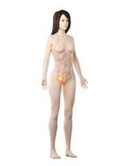 Fototapeta premium 3d rendered medically accurate illustration of a womans urinary bladder cancer