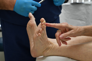 Podiatry Patient Reflex 