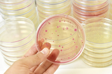 laboratory microbiology bacteria. Colonies of bacteria in petri dish in laboratory.