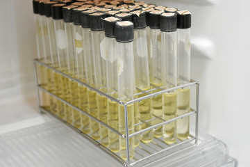 laboratory microbiology bacteria agar tube in incubator quality control process.