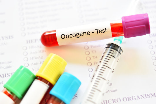Blood sample tube for oncogene test, cancer gene detection