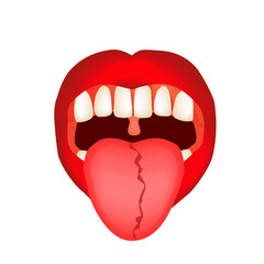 Curvature of the midline of the tongue. Definition of a disease according to human tongue. Diagnostics by tongue. Tongue Vector illustration on isolated background.