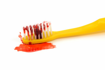 Oral Health Issues