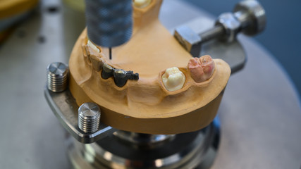 Zahntechnische Erstellung von Zahnersatz und Prothesen