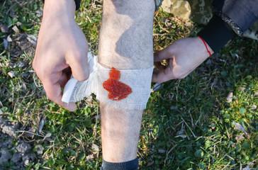 Man is putting bandage on bleeding wound. Injured leg. Tourist in the nature. Infection danger....