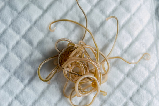 Close-up photo of Toxocara cati. Roundworms from a cat