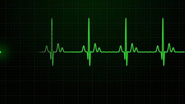 Loopable: Green EKG/ECG cardiogram oscilloscope monitor heartbeat line chart shows 60 BPM heart rate on black background with grid.