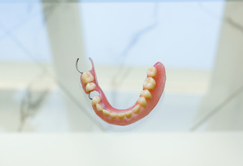 partial plate denture