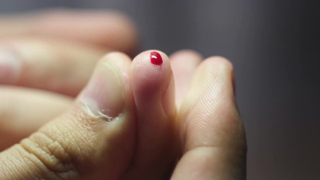 Diabetic finger with a drop of blood, close-up. Blood sugar test, macro