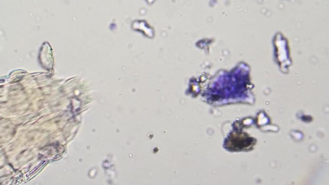 Microscopic view of planktonic rotifer in water