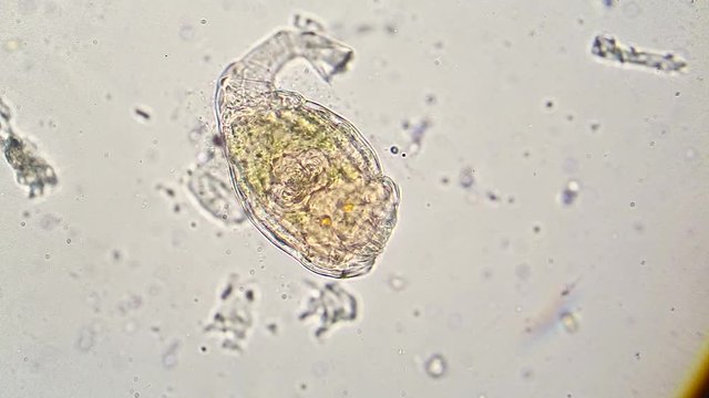 Details of aquatic creature under microscope, a female of rotifer
