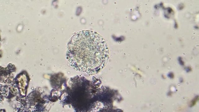 Amoeba at microscope