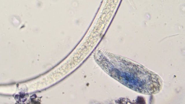 Caenorhabditis and paramecium at microscope