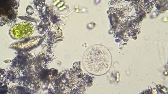 Spherical planktonic microorganism swimming in water