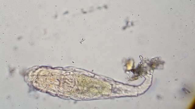 Microscopic view of rotifera