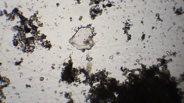 Paramecium and rotifera and paramecium in the water