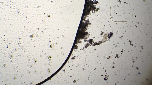 Couple of paramecium at microscope