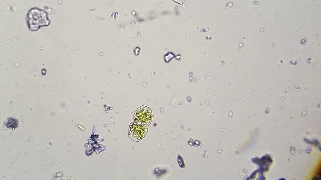 Microscopic green algae and Paramecium caudatum