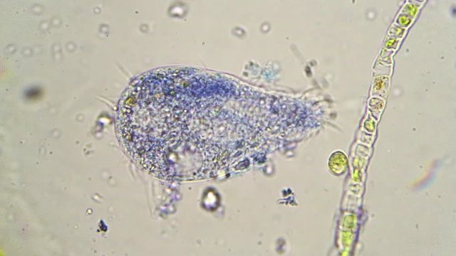 Blue paramecium near green algae
