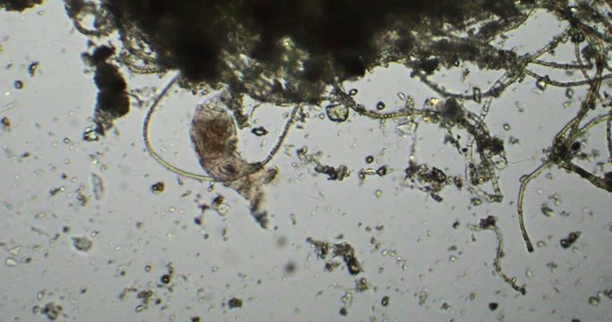 Aquatic life under microscope