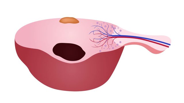 chocolate cyst graphic animation / ovary and uterus