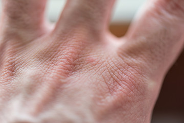close up photo of the back of the hand with blurred background and shallow depth of field. skin details