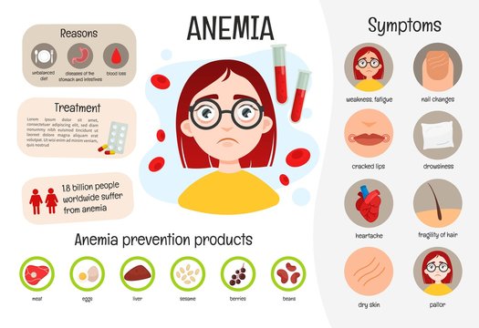 Iron Deficiency Anemia Images – Browse 1,079 Stock Photos, Vectors, and  Video | Adobe Stock