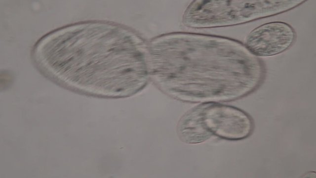 Paramecium caudatum is a genus of unicellular ciliated protozoan and Bacterium under the microscope.
