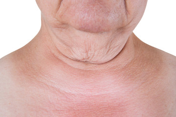 Flabby skin on the neck of an elderly woman isolated on white background
