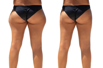 Before and after gluteoplasty surgery, a closeup and rear view on the legs and buttocks of a mature woman, results of successful buttocks reduction isolated against a white background.