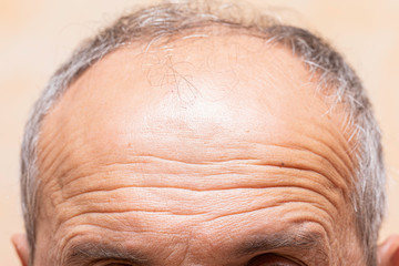 A closeup view on the lines and wrinkles in the forehead of an older man in his fifties, natural aging of the human body with receding grey hair.