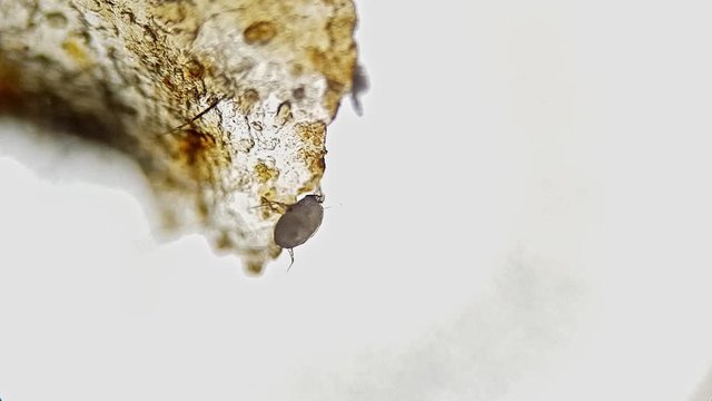 Ear swab of a cat's ear, heavy ear mite  infestation (Otodectes)