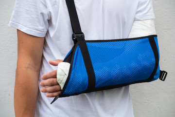 Man with broken arm wrapped medical cast plaster and blue bandage. Fiberglass cast covering the...