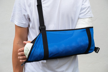 Man with broken arm wrapped medical cast plaster and blue bandage. Fiberglass cast covering the...