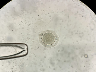 View through microscope at in vitro fertilization process