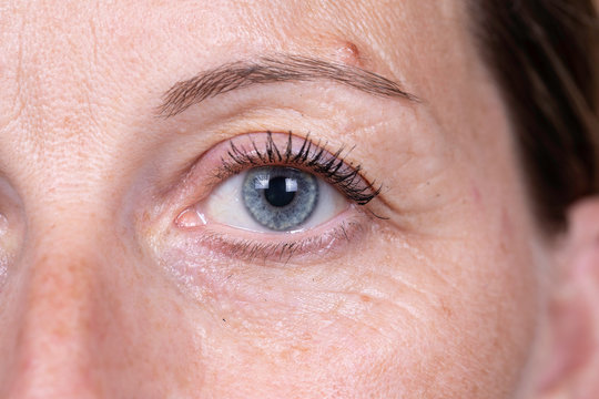 A closeup, macro detailed view on the blue eye of a beautiful caucasian woman in her early forties, natural again is seen with crow's feet and blemishes of the skin.