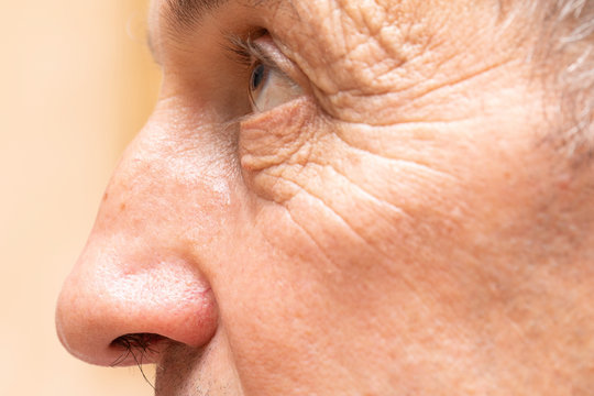 A Closeup And Side Profile View On The Face Of A Fifty Year Old Man, Mature Aging Is Seen With Heavy Wrinkles, Crow's Feet And Nasal Hair.