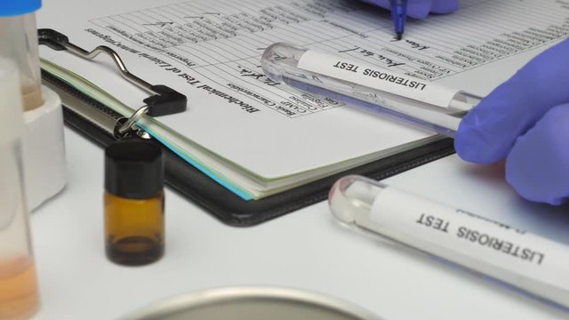 Scientific expert analyzes samples after the crisis of listeriosis caused by meat stuffed in Spain